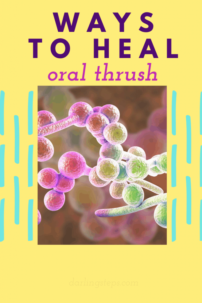 Ways To Cure Oral Thrush Darling Steps